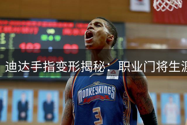 迪达手指变形揭秘：职业门将生涯的无声勋章